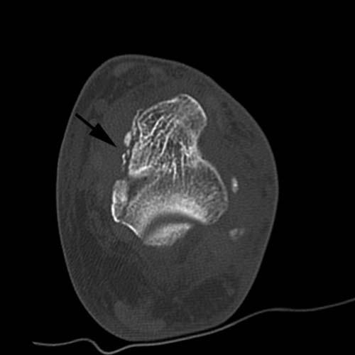 Radiologic Image