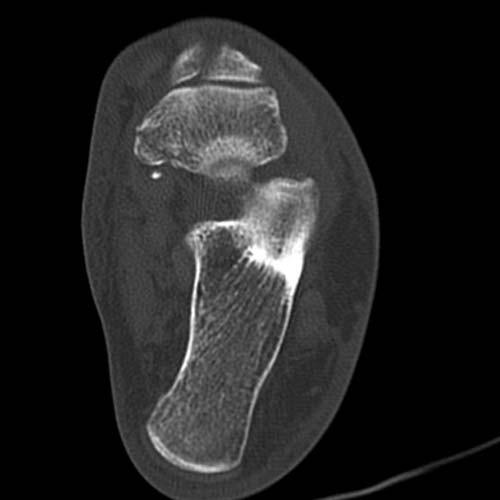 Radiologic Image