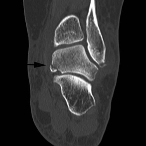 Radiologic Image