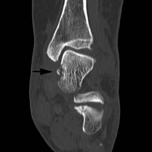 Radiologic Image