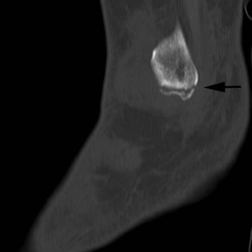 Radiologic Image