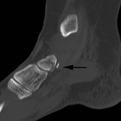 Radiologic Image