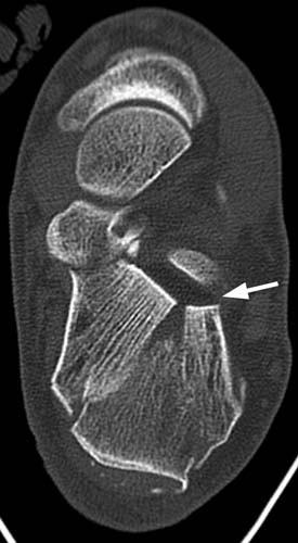 Radiologic Image