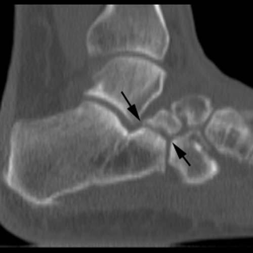 Radiologic Image