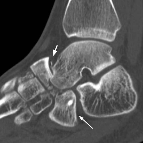 Radiologic Image