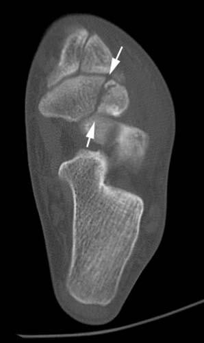 Radiologic Image