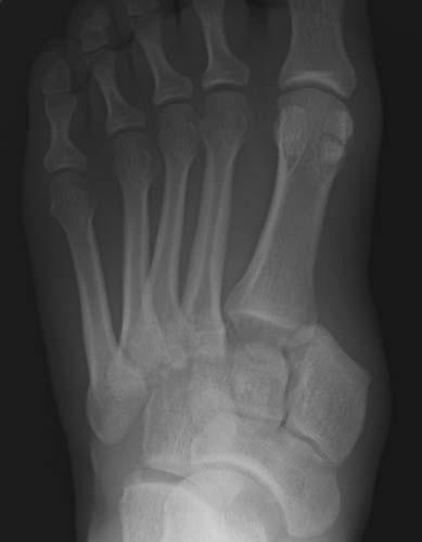 Radiologic Image