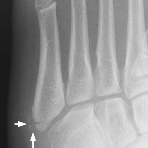 Radiologic Image