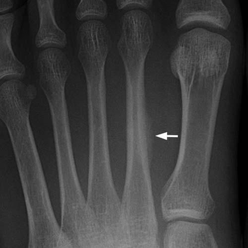 Radiologic Image