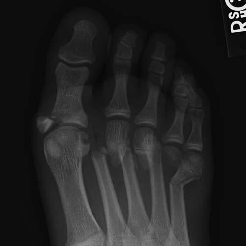 Radiologic Image