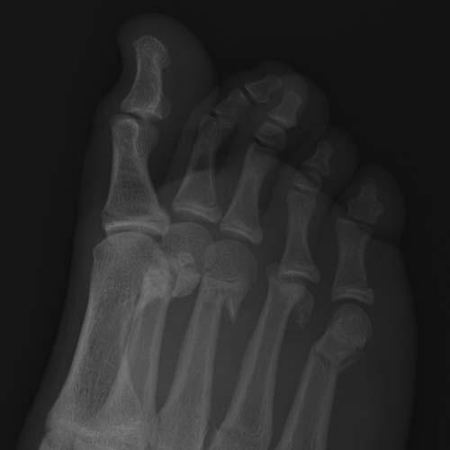 Radiologic Image