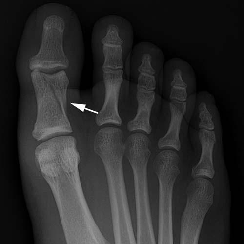 Radiologic Image