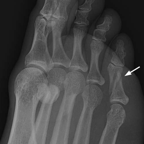 Radiologic Image