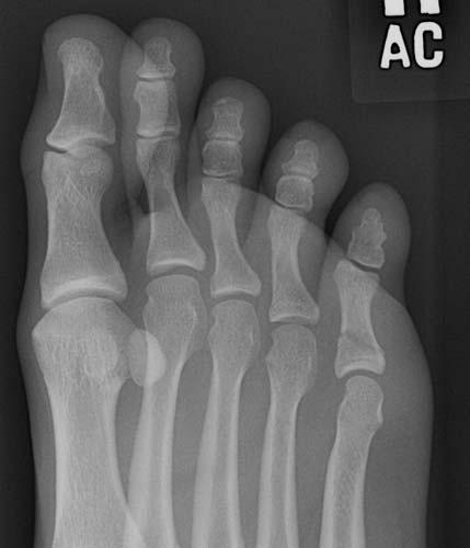 Radiologic Image