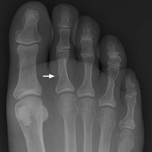 Radiologic Image