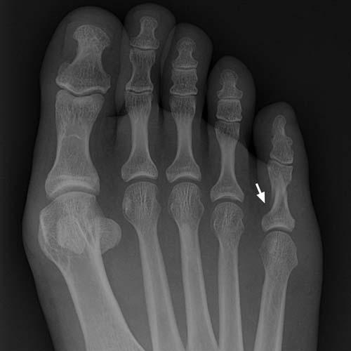 Radiologic Image