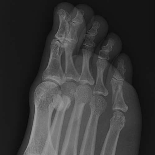 Radiologic Image