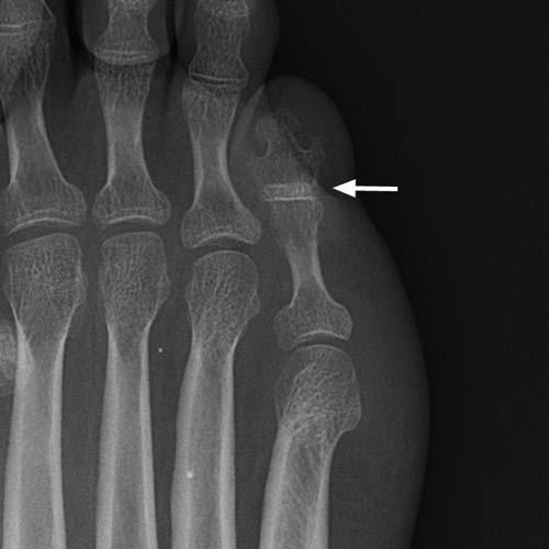 Radiologic Image