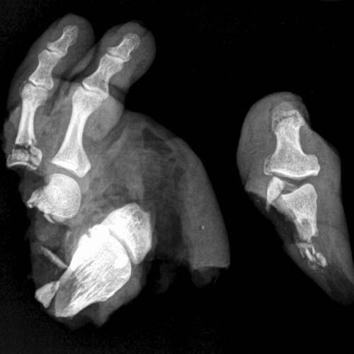 Radiologic Image