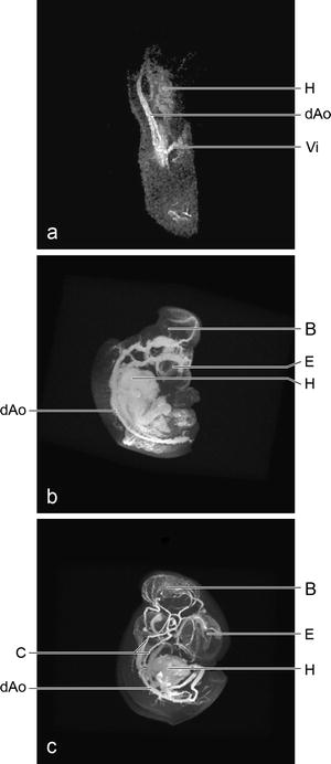 MRI to Study Embryonic Development