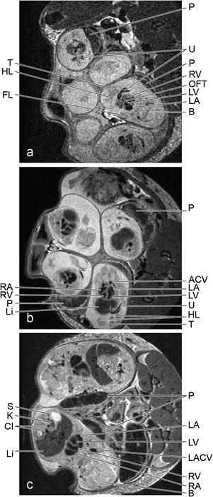 A184233_1_En_30_Fig4_HTML.jpg