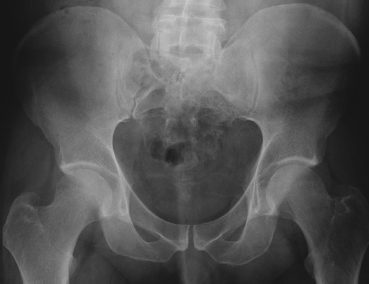 Pelvis | Radiology Key