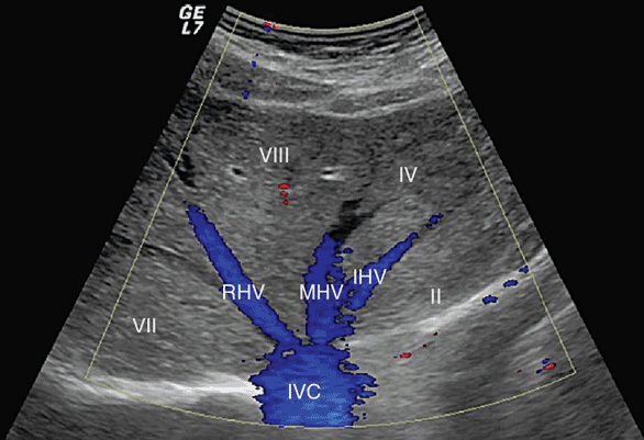 Hepatobiliary Ultrasound | Radiology Key iv vein diagram 