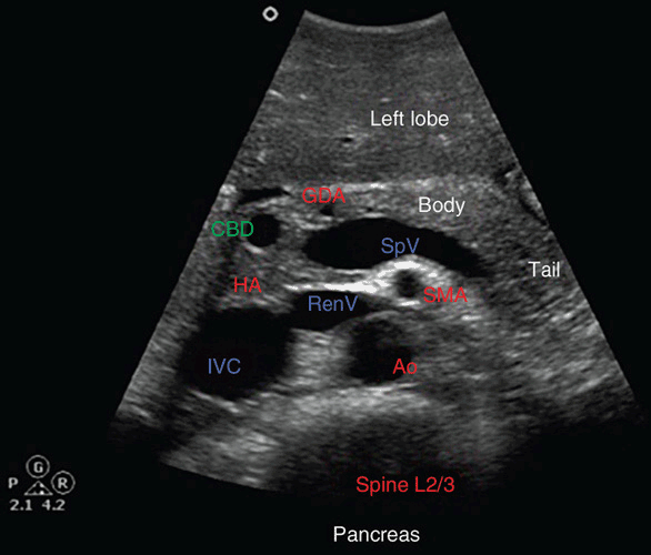 Pancreas Ultrasound Anatomy Anatomical Charts Posters | Sexiz Pix