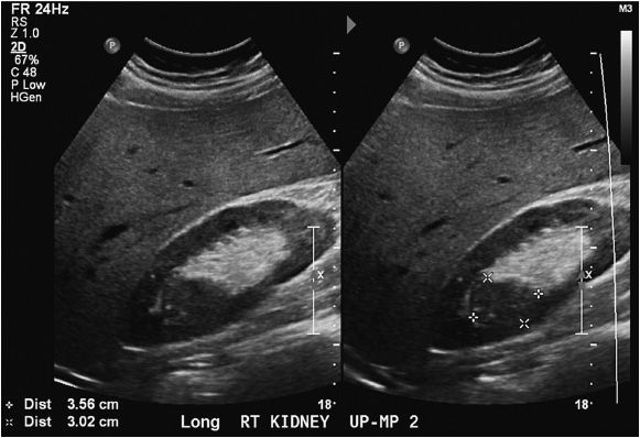 Genitourinary Ultrasound Radiology Key Genitourinary Ultrasound Radiology Key