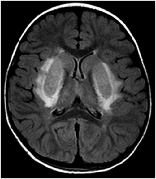 34 | Radiology Key