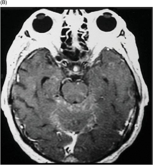 40 | Radiology Key