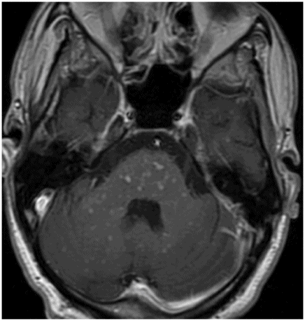 56 | Radiology Key