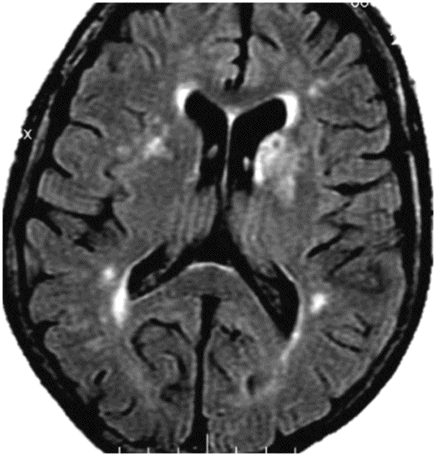 64 | Radiology Key