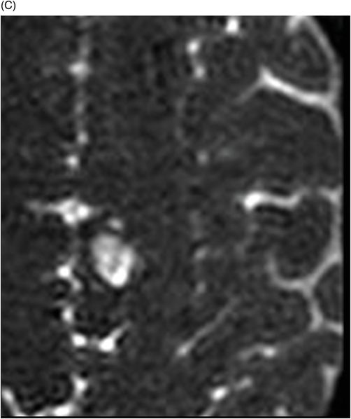 111 | Radiology Key