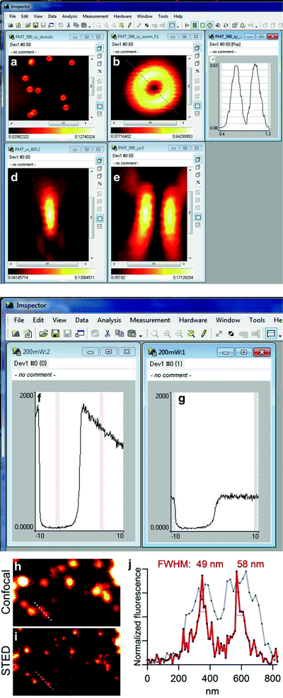 A213664_1_En_5_Fig3_HTML.gif