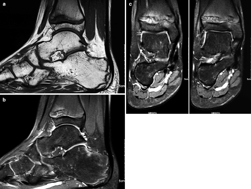 Sports-Related Musculoskeletal Lesions in Pediatric Patients ...