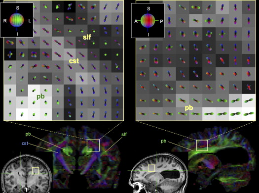 Visualizing White Matter Pathways in the Living Human Brain: Diffusion ...