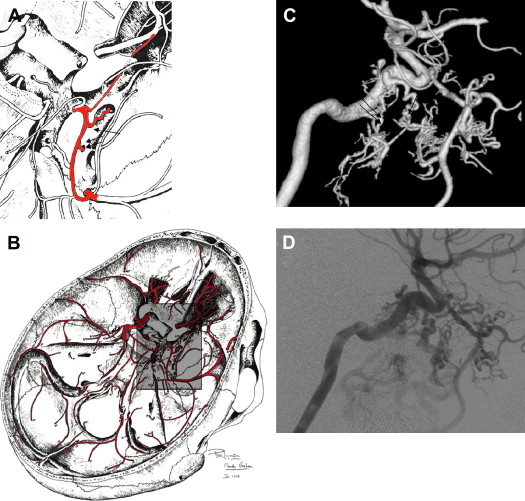Arterial Vascularization Of The Cranial Nerves Radiology Key