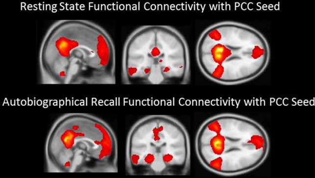 Memory Assessment In The Clinical Context Using Functional Magnetic