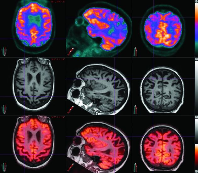 Common Techniques Used In Neuroimaging | Radiology Key