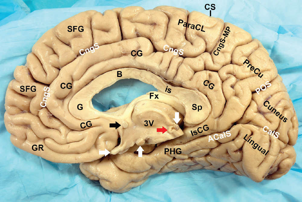 Normal Anatomy of the Brain: What You Need to Know | Radiology Key