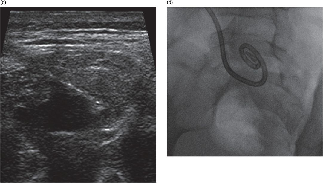 Radiological identification and analysis of soft tissue musculoskeletal  calcifications, Insights into Imaging