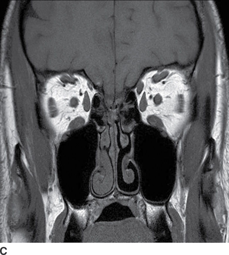 The Cranial Nerves | Radiology Key