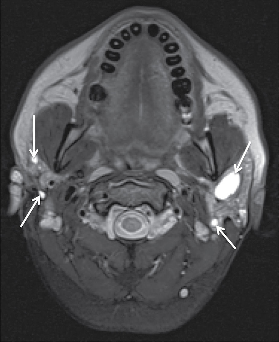 The Glands Salivary Thyroid And Parathyroid Imaging Radiology Key