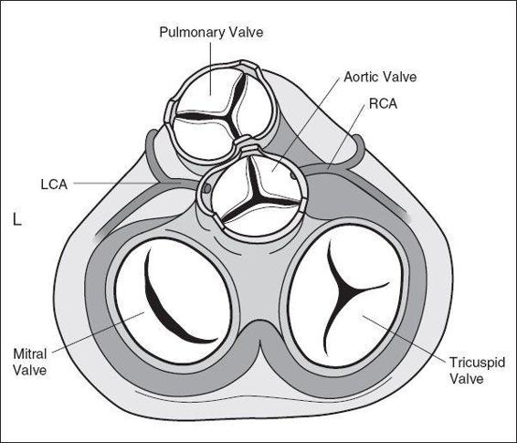 Great Vessels | Radiology Key