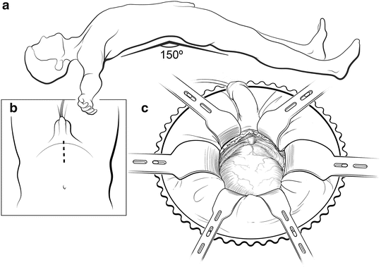 Fișier:1116 Muscle of the Male Perineum.png