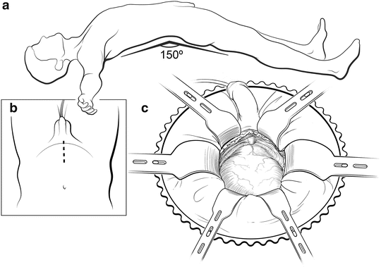 A307029_1_En_7_Fig2_HTML.gif