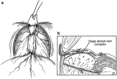 A307029_1_En_9_Fig2_HTML.gif