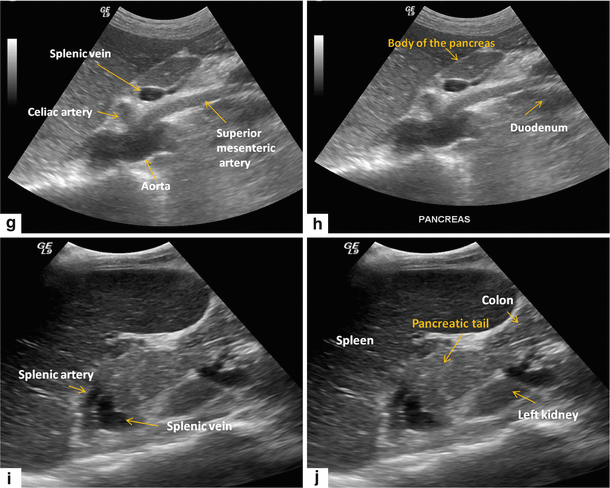 abnormal pancreas ultrasound