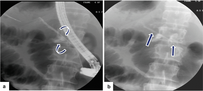 Imaging of the Pancreas | Radiology Key